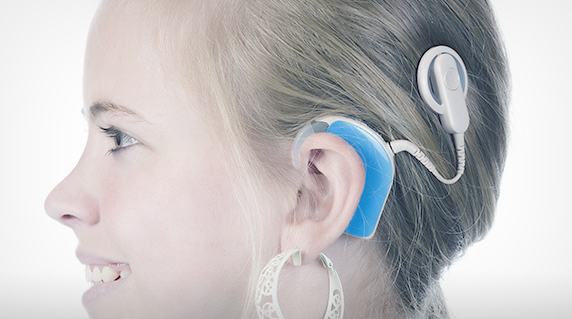 Cochlear implantation program